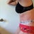 This is me 6 days after surgery facing left!  (I still can't stand up totally straight per my surgeons instructions)