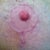 Left nippy