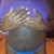 Stomach before Tummy Tuck -