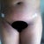 Swelling in pelvis