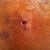 Drain hole ... I didn't drain right so they took it out on day 4. I did get a seroma but they drained it and i was fine. RELIEF!