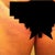 Pelvic Bruise that I was talking about.