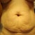 2 days before surgery