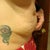 2 days before surgery