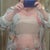 Day 2 . No bra. Wrapped with ace bandages and tape.