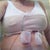 Day 5 pic. Visited PS on day 4 and was given bra