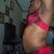 My left side 2 days pre-op.
