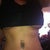 3 weeks post op