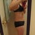 1 week post op