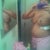 3 days Post Op