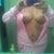 3 Days Post Op