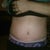 5weeks 4 days po