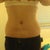 After/ 5 days post-op