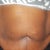 Before my surgery