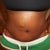1 month after surgery......still swollen