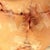 Under the right breast. A little concerned about the wound not be closed right enough.