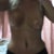 9 days post op sorry its a bit blurry i still have swelling arounbd the tummy thighs and hips but feeling better