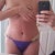 Day 3 PO - in my pre-op undies