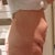 Before. Side view.  Yuck! :-(. I was soooo sad and miserable.