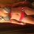 1st bikini.  8 days post op.  first day in a bikini in 17 years.