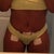 4 day post op LIPO of flanks, abs and thighs