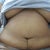 2 months sitting.  Are you kidding me?  Did I really have a tummy tuck?