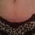 Pre opt pic front of "belly hang"