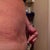see where my pubic area is sticking out more than my belly