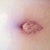 BB is healing well. Still not sure if that hole at the top will stay or close though.