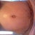 PO 5 wks 2 days