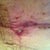 Incision at T Join not healing. It's very weepy and I have to put a plaster over It or it drips. Any suggestions on how to help it dry up.