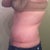 WK 12 AM swelling comparison