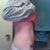 PO Day 7More swollen on my right side.