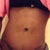 Swell hell go away even at 6 wks 6 days po.