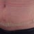 My scar.  The stretch mark right below my belly button is still puffy.  Freddy says when it begins to look like a normal stretch mark (flat), I will know that I don't have any more swelling.