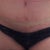Another pic of my scar.