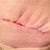 My "pleated" love handles! PO day 14. Dr says this should flatten out. ?