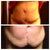 Here is my before 12/5/2012 and my 1 month picture 1/6/2013