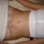 Tummy, one day post op.