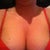 The ancillary fat I'm having lipo on.