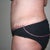Side - 1 day post-op