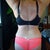 7 Weeks Post OP