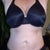 14 WEEKS POST OP