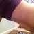 before- hanging skin when I lean foward