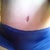 still some redness from bb scar