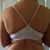 Pre-op back