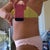 Pre-op left side