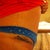The scar looks SO ugly! The mesh over the suyures makes me look like frankenstein :(