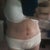 PO Day 8. Rough day but I guess because I laid around all day my swelling is down. I have ab definition!