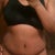 Wk6 TT- morning shot (mild swelling)